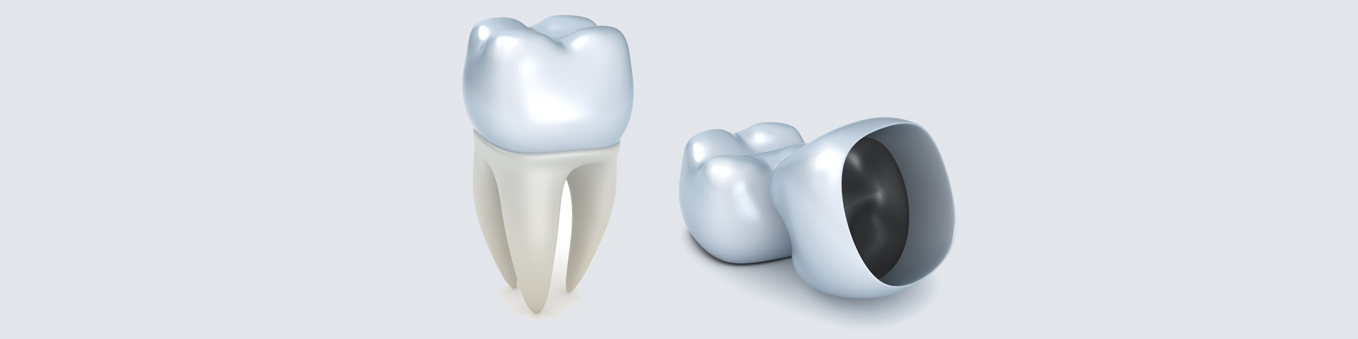 Dental Crowns