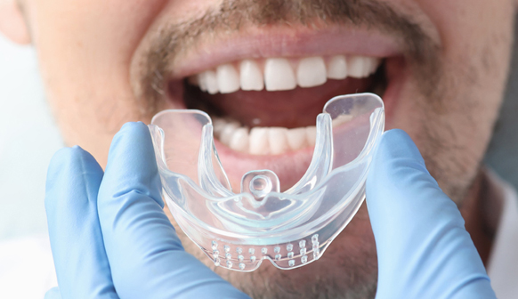 Dental Guards in Bakersfield