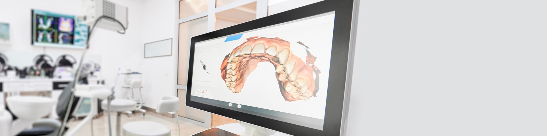 Oral Cancer Screenings