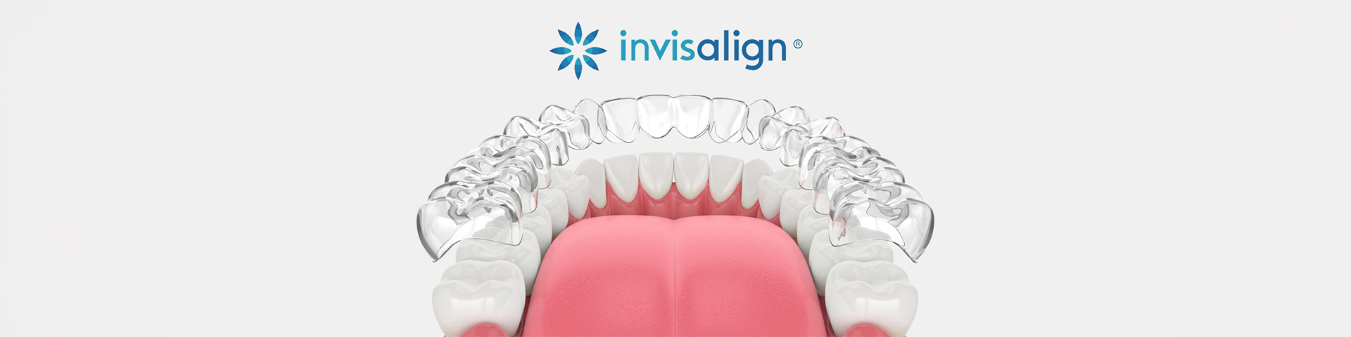 Invisalign